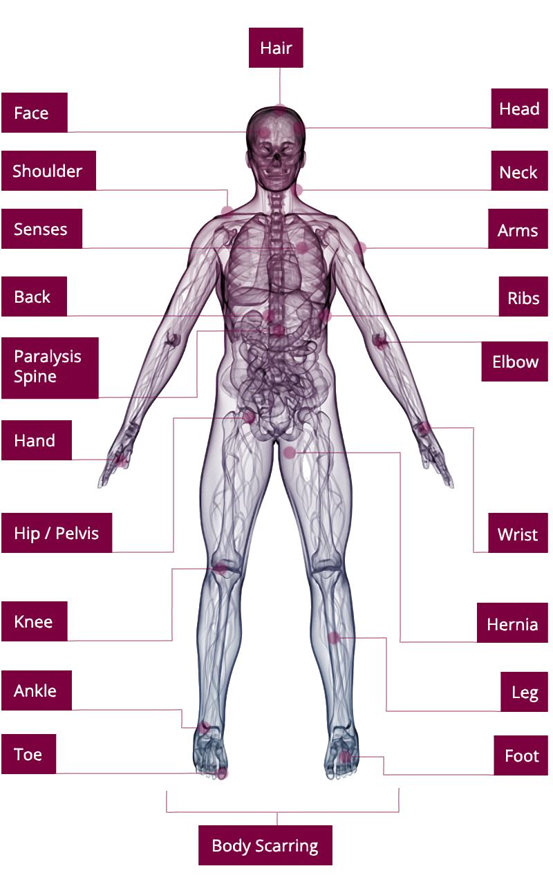 symptoms of mesothelioma cancer